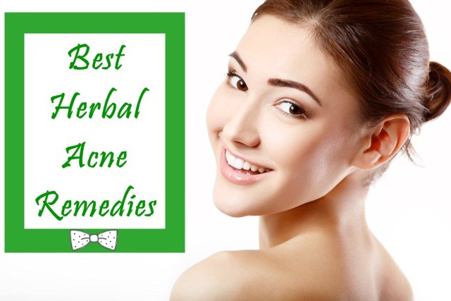 Best Herbal Acne Remedies