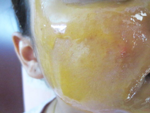 I Love Mango Face Mask on face