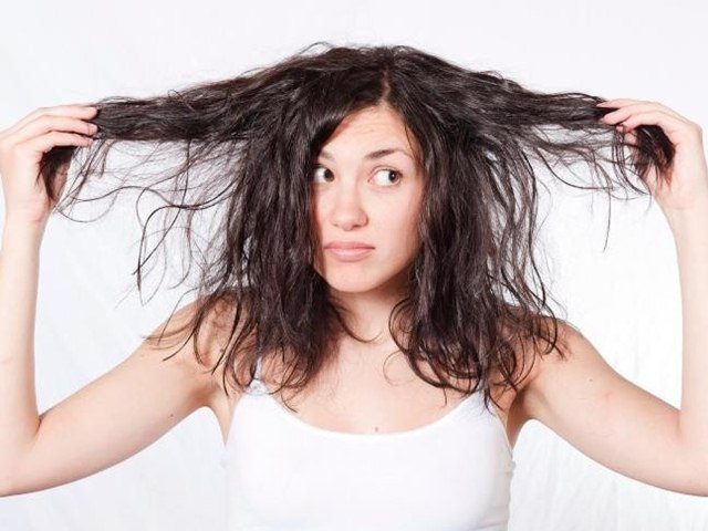 Oily Hair in Summer, Oily Hair Treatment, Tips to get rid of oily hair, How to treat oily hair in summer