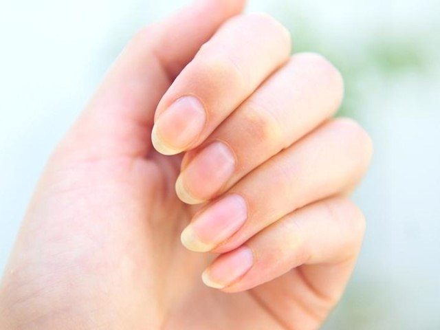 Home Remedies to Strengthen Brittle Nails 2, Natural Remedies to treat Brittle Nails, How to treat brittle nails, nail care tips